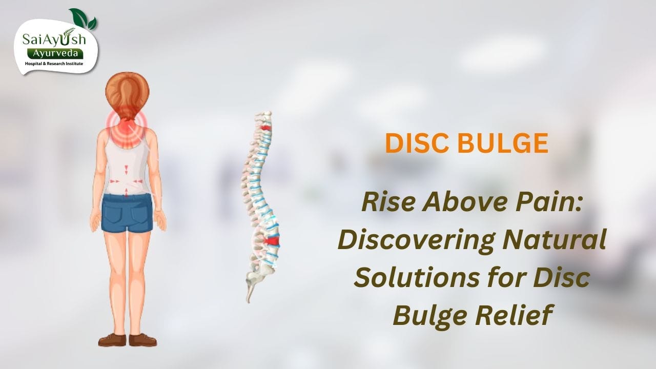 Disc bulge