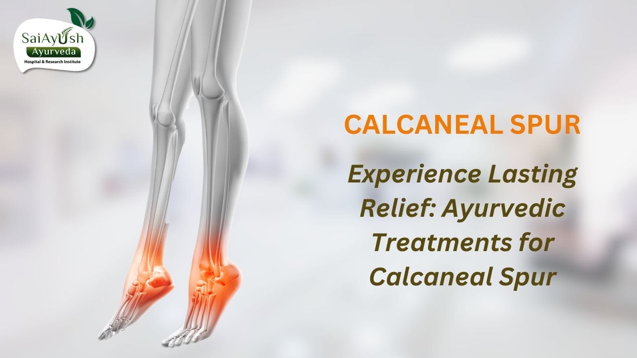 Calcaneal spur