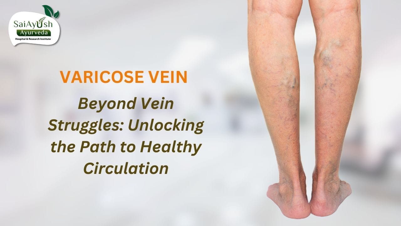 varicose vein varicose vein