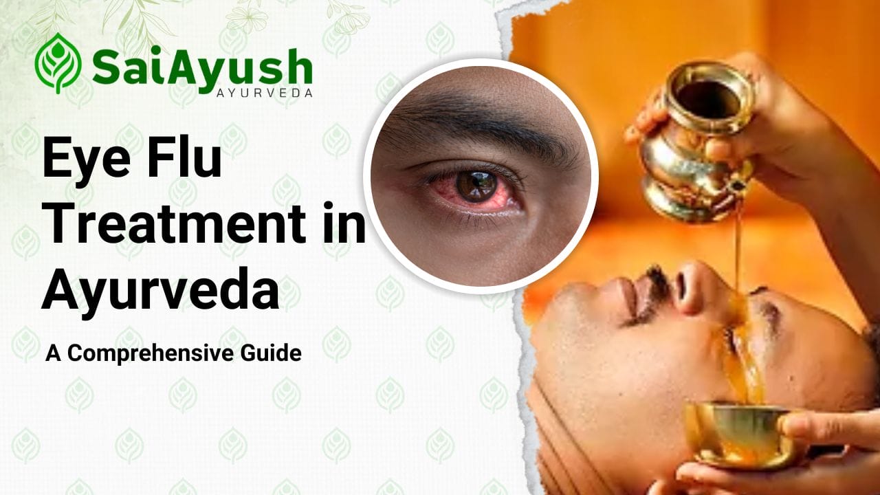 eye flu treatment1
