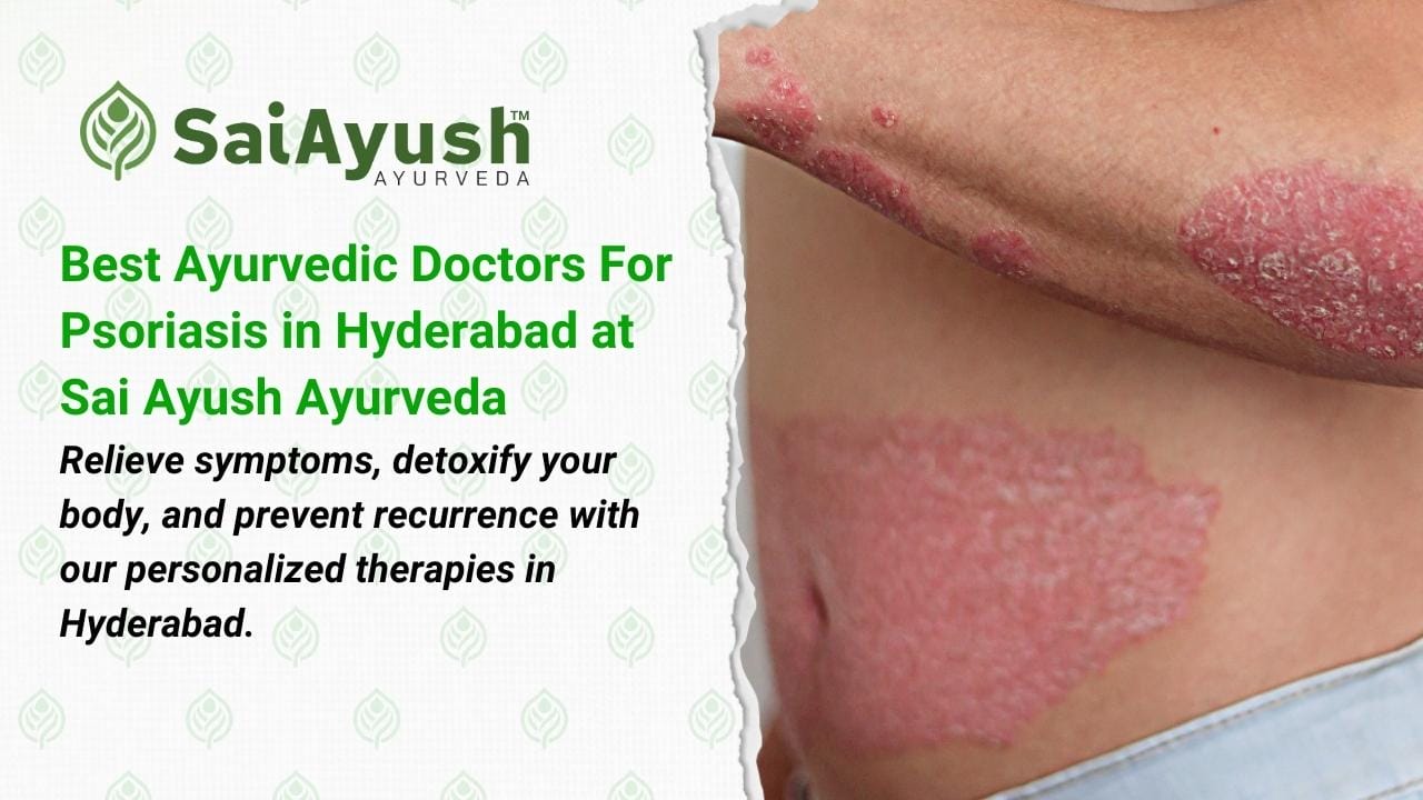 Best-Ayurvedic-Doctors-For-Psoriasis-in-Hyderabad